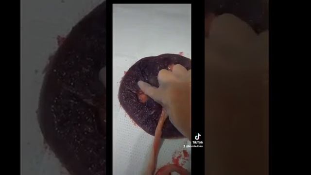 Postpartum In Placenta Infarction смотреть онлайн