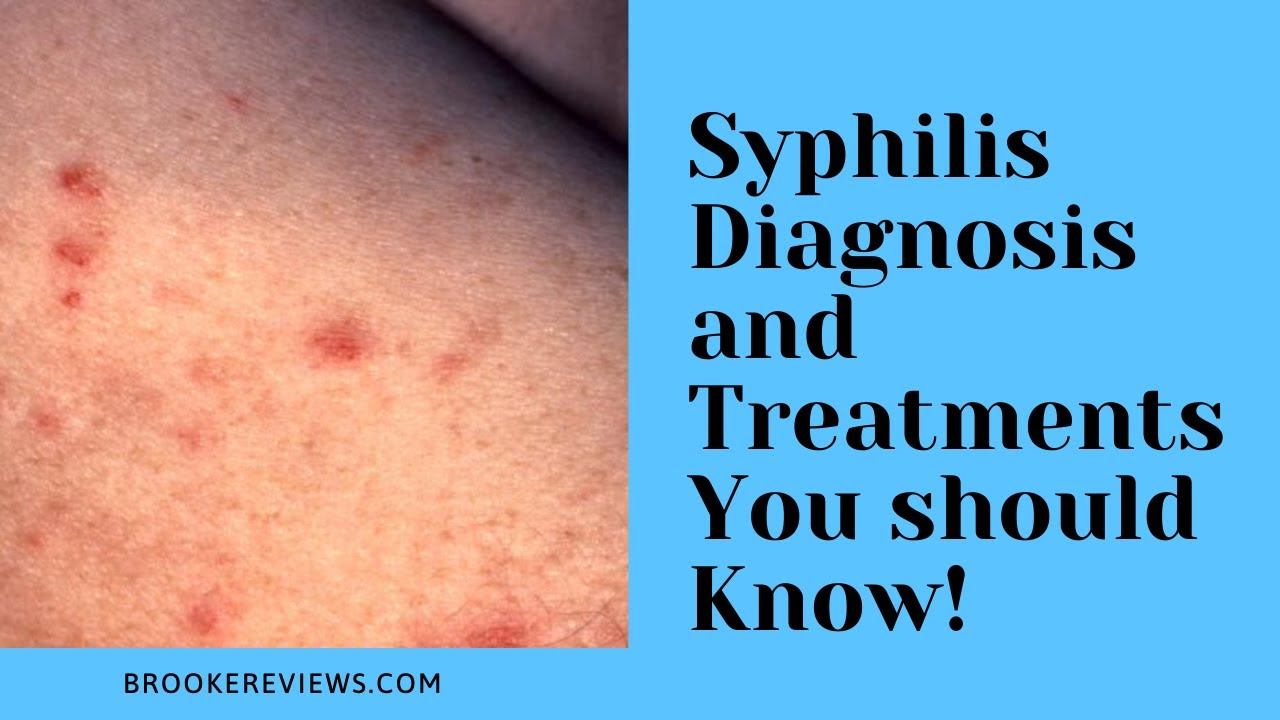 Syphilis Diagnosis and Syphilis Treatment You Should Know! смотреть онлайн