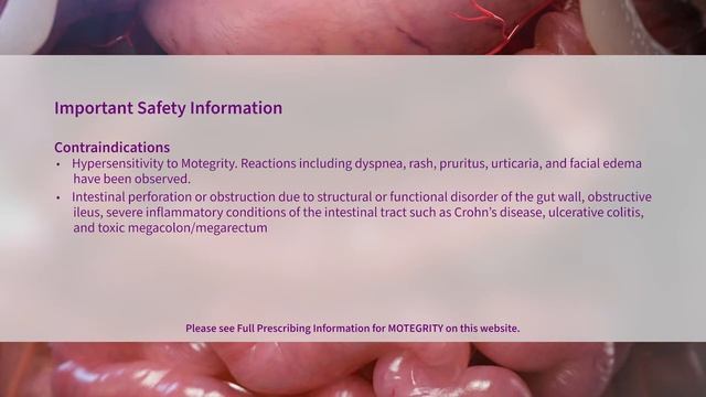 Colonic Motility and Accelerated Transit Time | Motegrity® (prucalopride) смотреть онлайн