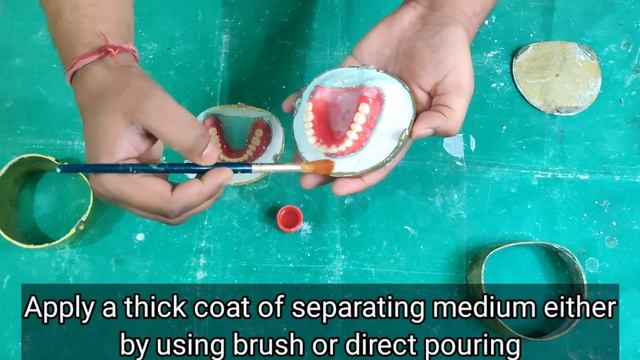 Flasking of Complete Denture смотреть онлайн
