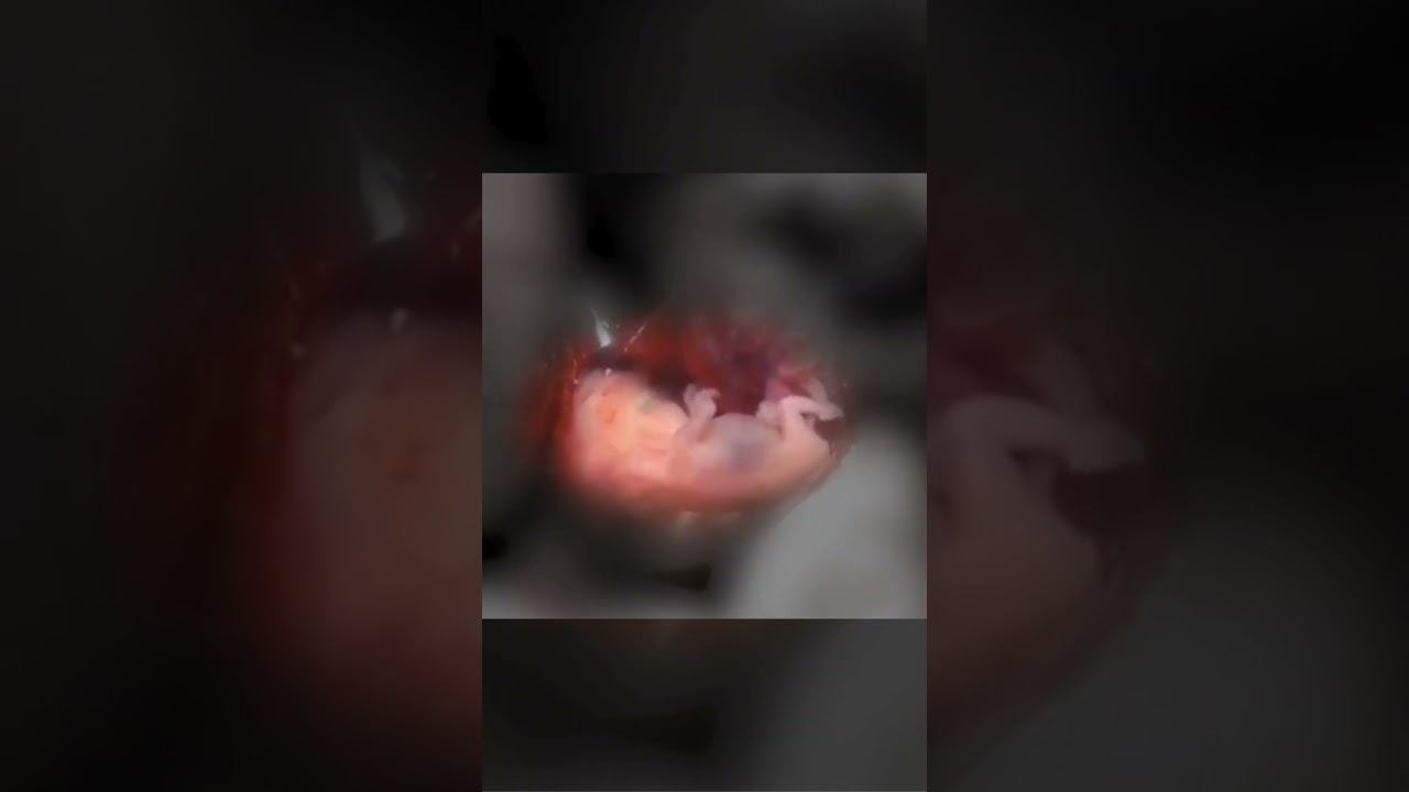 A Baby 8 Weeks After Fertilization смотреть онлайн