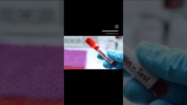 ferritin #laboratory #gk #microscopy #aarogyam #reel #surat #suratcity #biochemistry #photography смотреть онлайн