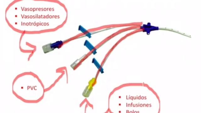Recomendaciones Para Puertos Vía Central