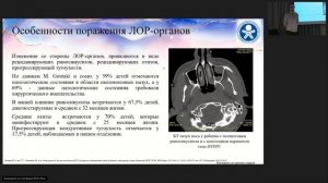 Семинар "Пульмонология мегаполиса" №4/24 от 26 марта 2024 года
