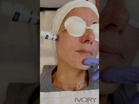 Clear lift and clear skin laser - Ivory Aesthetics Clinic - Dubai смотреть онлайн
