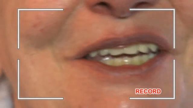 Bayer Heatlhcare PH My Breathless Story Video Diary] смотреть онлайн