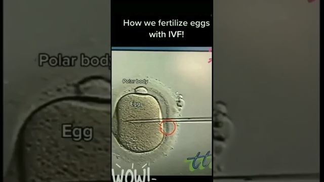 Fertilization by IVF. 😮😲😲 смотреть онлайн