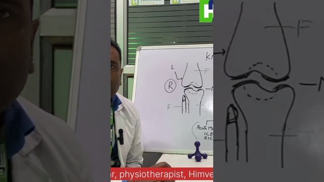 Pain around Patella How to Cure it Basic Knee Joint Anatomy. смотреть онлайн