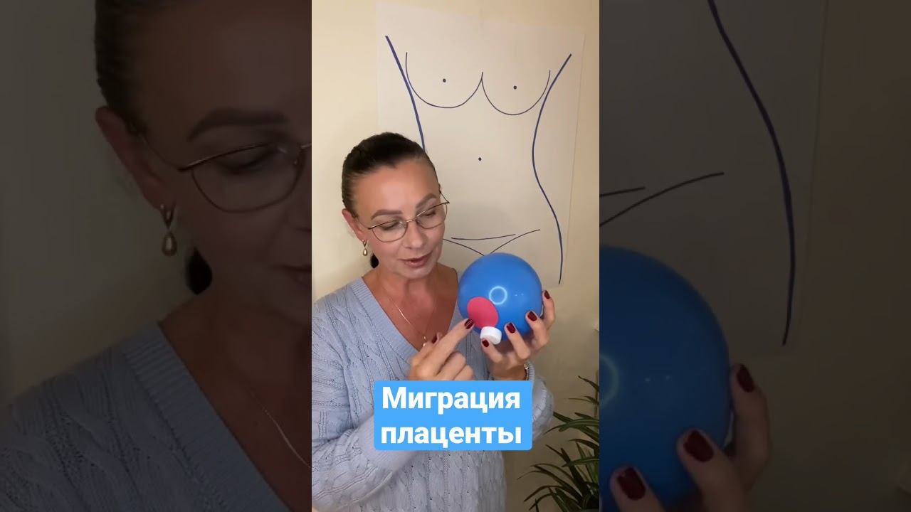 Что такое миграция плаценты? смотреть онлайн