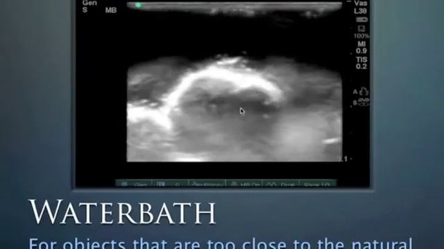 10 Soft Tissue Ultrasound смотреть онлайн