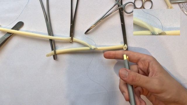 End-to-side vascular anastomosis, fixed donor limb, 2023, extended смотреть онлайн