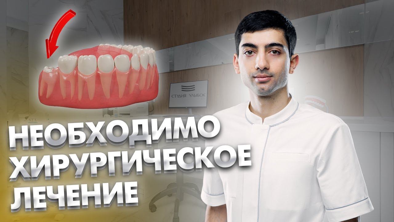 Ретинированный восьмой зуб, оплетенный тройничным челюстным нервом смотреть онлайн