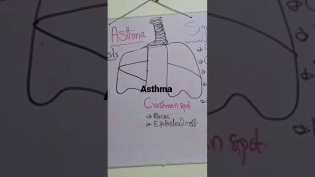 #Asthma#Signs#Symptoms#Short##viral#karachi##Nursing