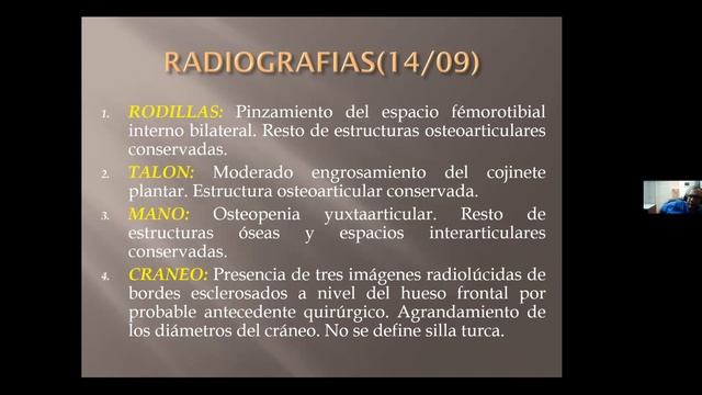 Caso clínico ( Adenoma de GH) 2 смотреть онлайн