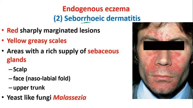 010 Atopic dermatitis and other endogenous eczemas смотреть онлайн