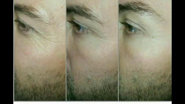Instent lifting serum смотреть онлайн