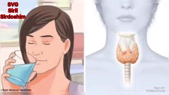 Qalqonsimon Bez Kasalligi Ko’ring Nimani Keltirib Chiqaradi