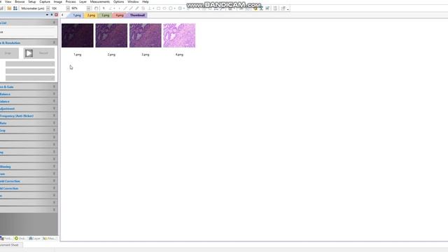 ImageView Microscope Camera Software: High Dynamic Range (HDR) смотреть онлайн