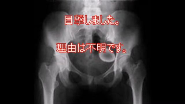 【閲覧注意】よい子はこうもんであそんではいけましぇ～～んｗｗｗ смотреть онлайн