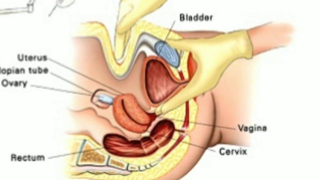 Cervix Open Symptom Malayalam|Cervical Dilation|PV Pregnancy смотреть онлайн