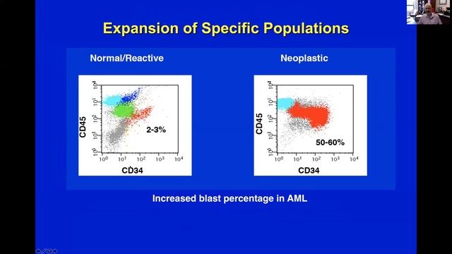 NK@UIPathology: #GoWithTheFlow-Video3: HOW DO WE KNOW THAT A POPULATION IS A TUMOR/"NOT NORMAL"? смотреть онлайн