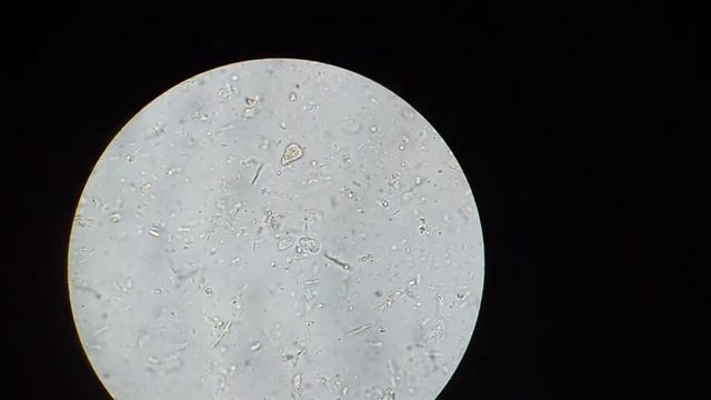 Trofozoito de chilomastix mesnili смотреть онлайн