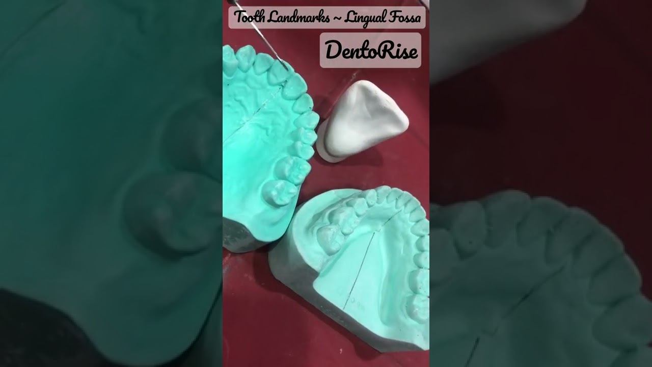 Landmarks on tooth surfaces | LINGUAL FOSSA | Short video LINK IN DESCRIPTION | Dental Anatomy смотреть онлайн