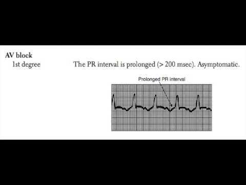 USMLE Cardiovascular System 8 - The Electrocardiogram (ECG or EKG) смотреть онлайн