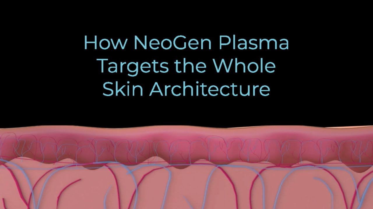How NeoGen Nitrogen Plasma Targets the Whole Skin Architecture for Skin Resurfacing смотреть онлайн