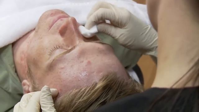 DE FILOSOFIE VAN PCA SKIN смотреть онлайн