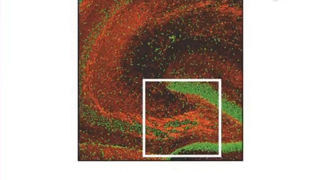NF-kB dependent Neurogenesis modulation and analysis | Protocol Preview смотреть онлайн