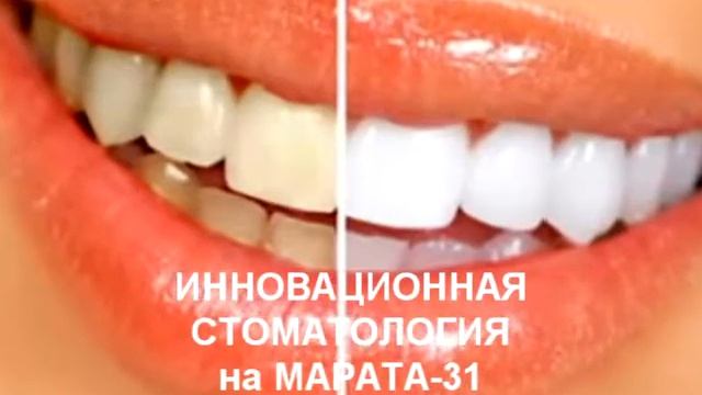 Отбеливание зубов смотреть онлайн
