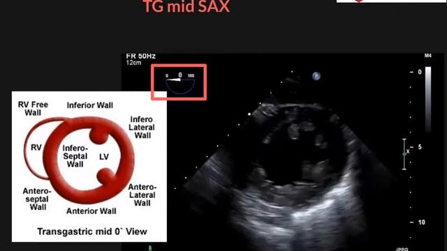 TEE TG mid SAX смотреть онлайн