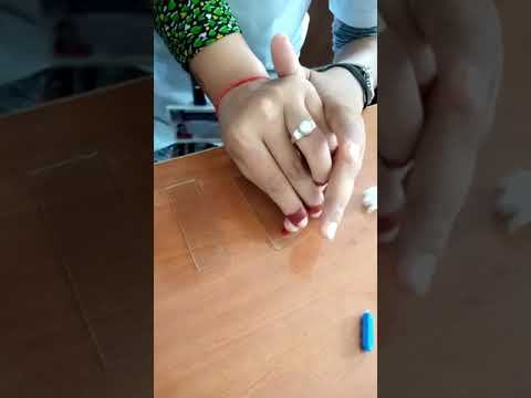 different leucocyte count steps (DLC) смотреть онлайн
