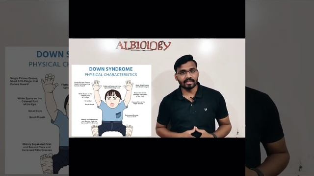 Down's Syndrome | 21-trisomy | Inheritance and variations | Avinash sir | Viral short смотреть онлайн