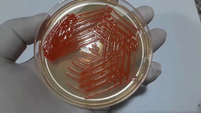 Serratia marcescens growth on Muller-Hinton agar with pigment expression Demonstration смотреть онлайн