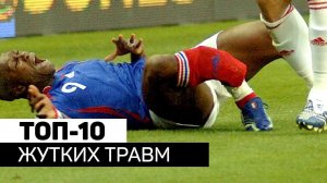 ТОП 10 САМЫХ УЖАСНЫХ ТРАВМ В ИСТОРИИ ФУТБОЛА! 18+