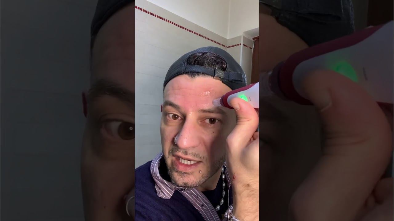 HYDRA PEN #hydrapen#facelift#pellerinata#acidoialuronico