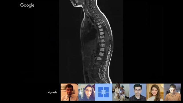 Neurosurgery Super Sunday April 8th #2 смотреть онлайн