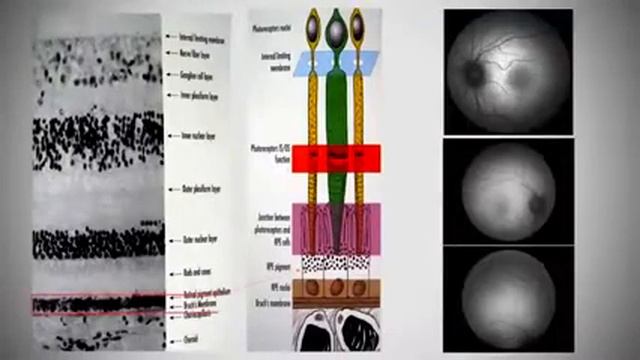 3D Canon Обучение АвтоФлуоресценция 2 смотреть онлайн