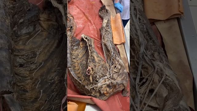 Сосуды верхней и нижней конечности смотреть онлайн