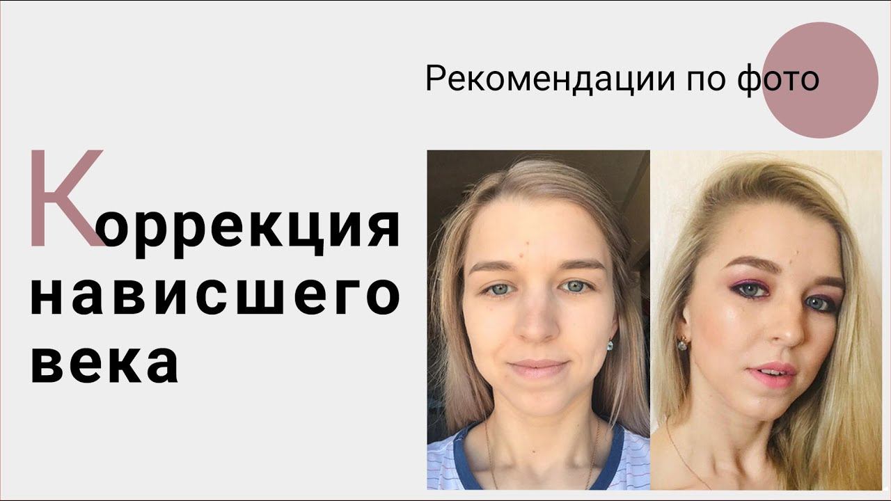 Коррекция нависшего опущенного века. Рекомендации по фото смотреть онлайн