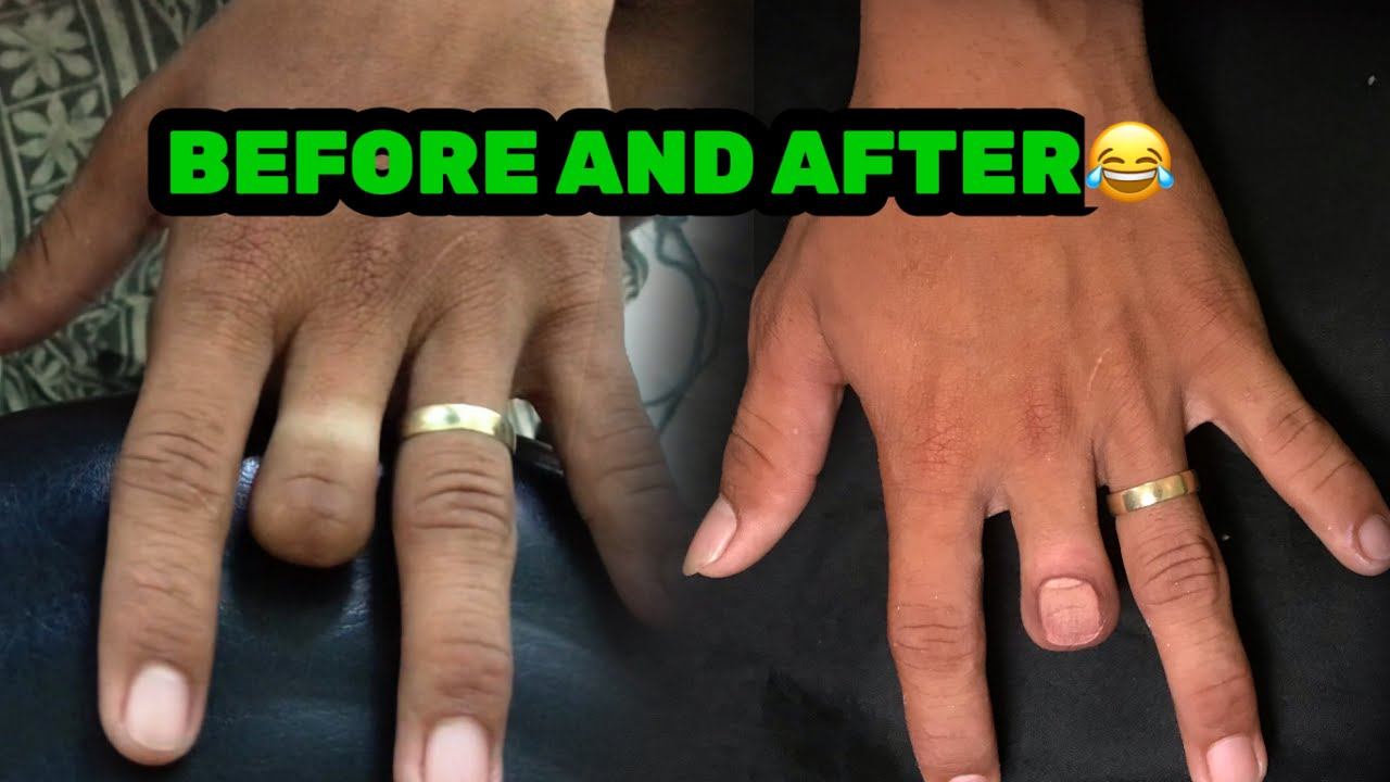 3d NAIL TATTOO | PUTOL NA DALIRI TINATUAN NG KUKO | ARONMOVEZ TV смотреть онлайн