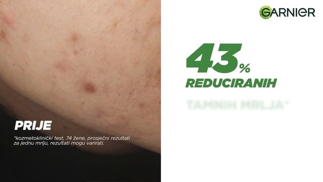 Garnier Vitamin C serum za lice смотреть онлайн