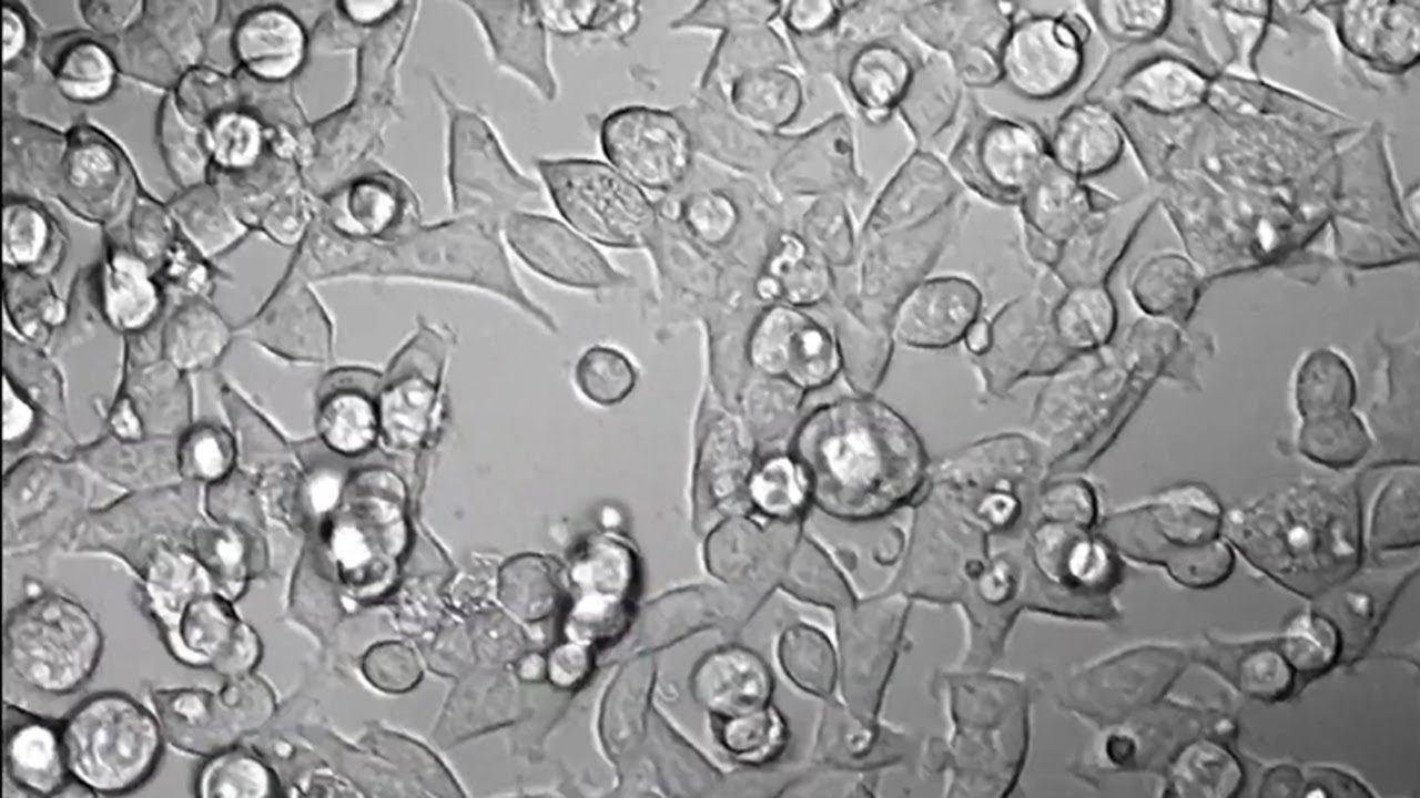 ‘Supercharged’ cells help scientists analyse SARS-CoV-2 variants faster смотреть онлайн