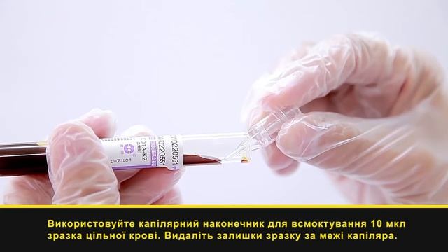 Автоматичний аналізатор А1. Тест для обстеження Глікогемоглобіну HbA1c за 5 хв. смотреть онлайн