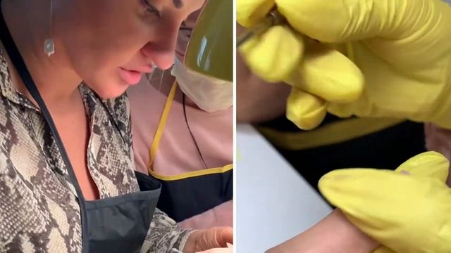 Анатомическая фреза смотреть онлайн