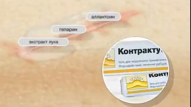 კონტრაქტუბექსი