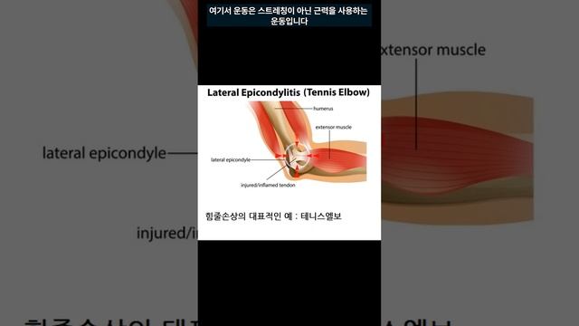 운동을 계속해도 되는 통증과 쉬어야 하는 통증의 구별은? смотреть онлайн