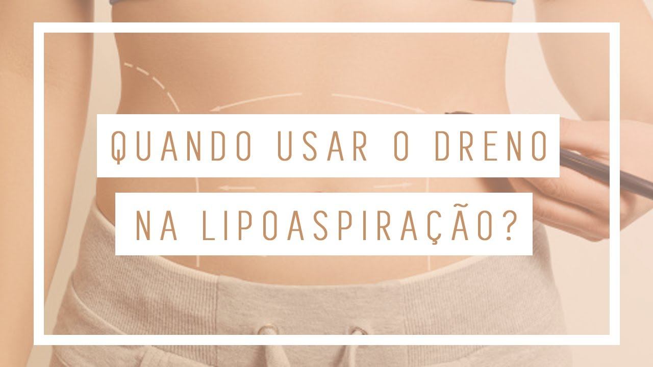 Quando Usar O Dreno Na Lipoaspiração? l Dr. Leandro Gontijo смотреть онлайн